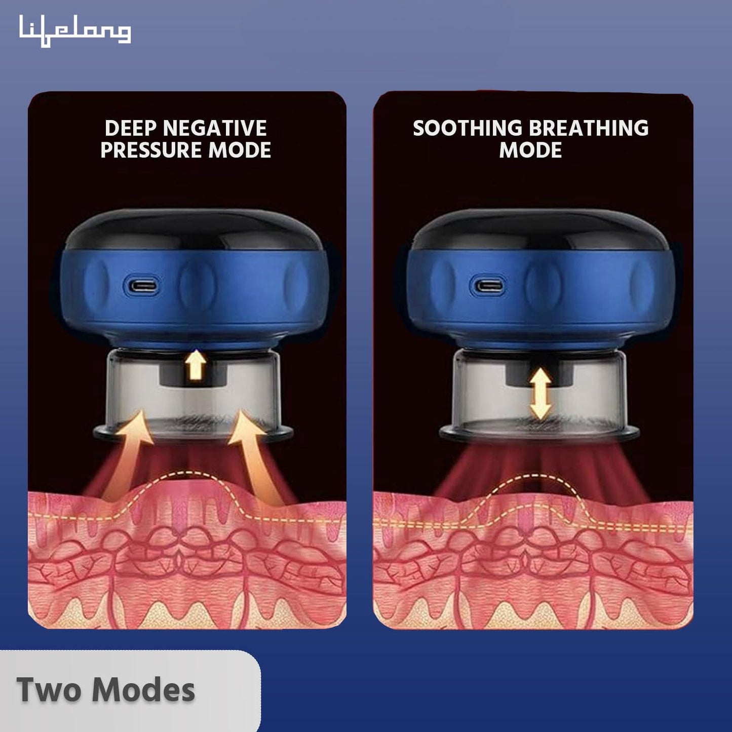 Smart cupping set