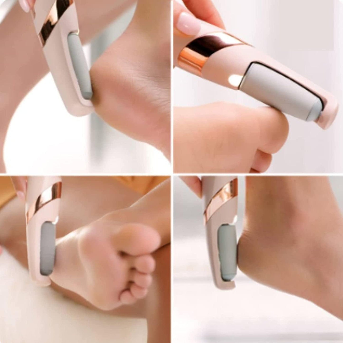Electric Foot Callus Remover
