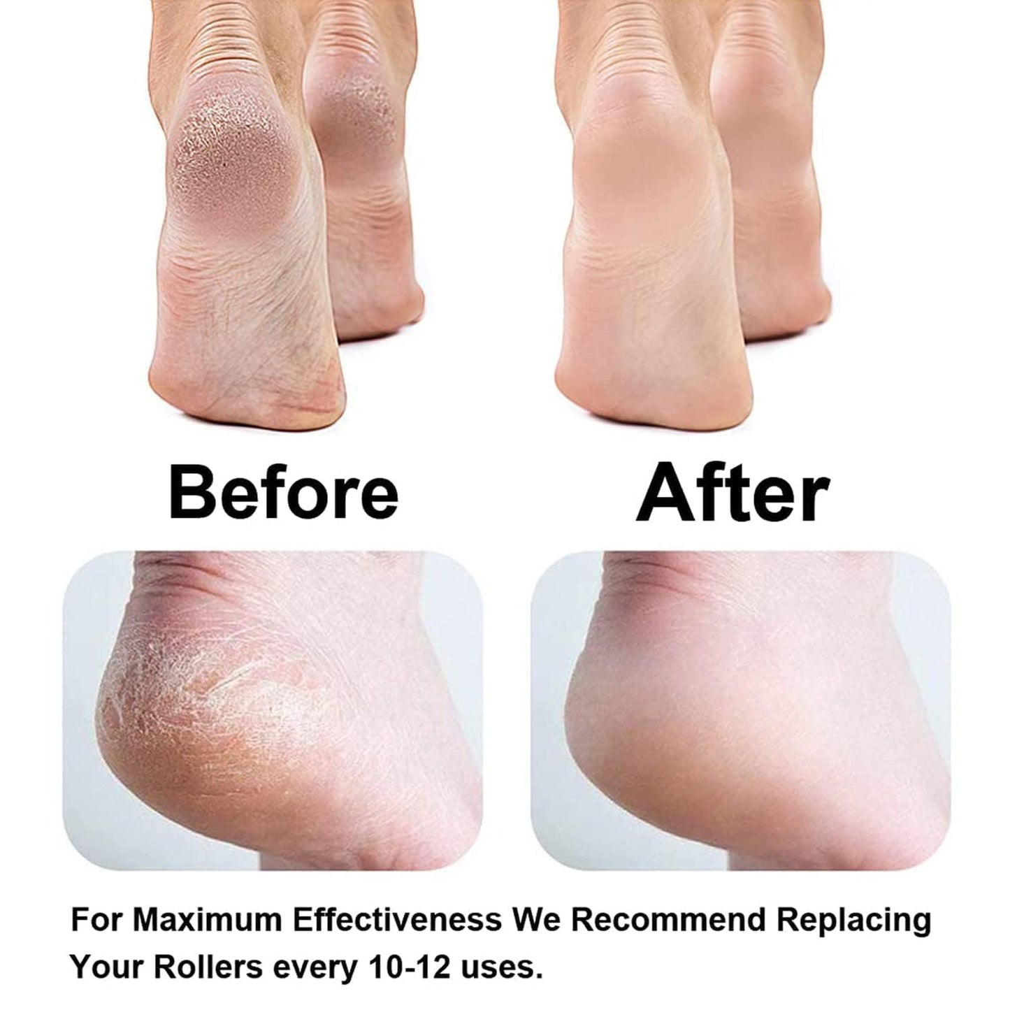 Electric Foot Callus Remover
