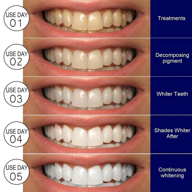 Teeth Whitening Strip